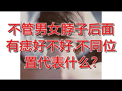 脖子後有痣