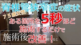 脊柱管狭窄症 ある箇所を5秒ほど施術するだけで改善！