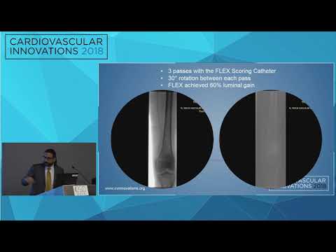 CVI2018 Session: A Tale of Two Lesions - Nicolas Mouawad, MD