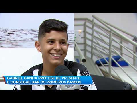 Jovem que teve perna amputada por linha chilena ganha prótese