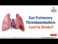 Pulmonary Thromboembolism Lead To Stroke Can Pulmonary Thromboembolism Lead To Stroke
