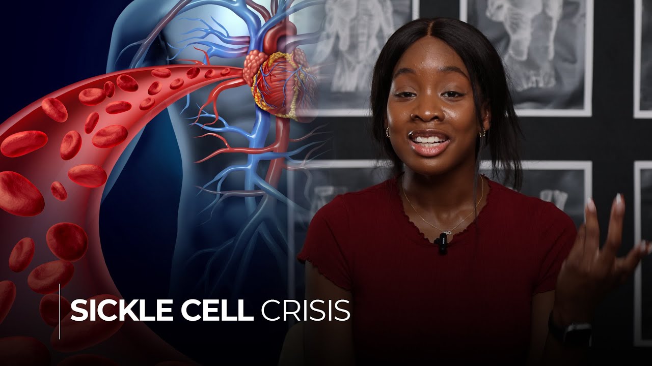 What Should Sickle Cell Patients Avoid Life Set Go
