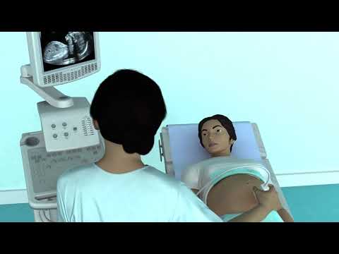 The Basic Steps of an Obstetric Ultrasound Examination
