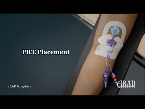PICC (Peripherally Inserted Central Catheter) Placement
