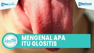 Apa itu Glositis, Peradangan Lidah yang Dapat Menghilangkan Sensor Papila