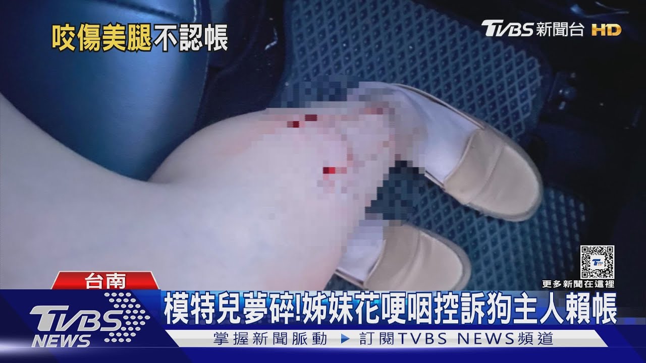 模特兒夢碎!狗咬傷姊妹腿怒控飼主不認帳 狗主人反駁