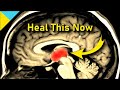 HEAL YOUR THALAMUS ❯❯❯ 2 Hz DELTA Waves • Neurologic Music Therapy • Quantum Miracle Formula Code