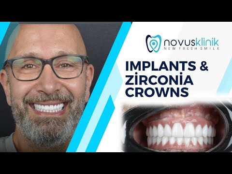 Implant Treatment and Smile Design at Novusklinik: Watch the Evaluation Video of Patient from Germany