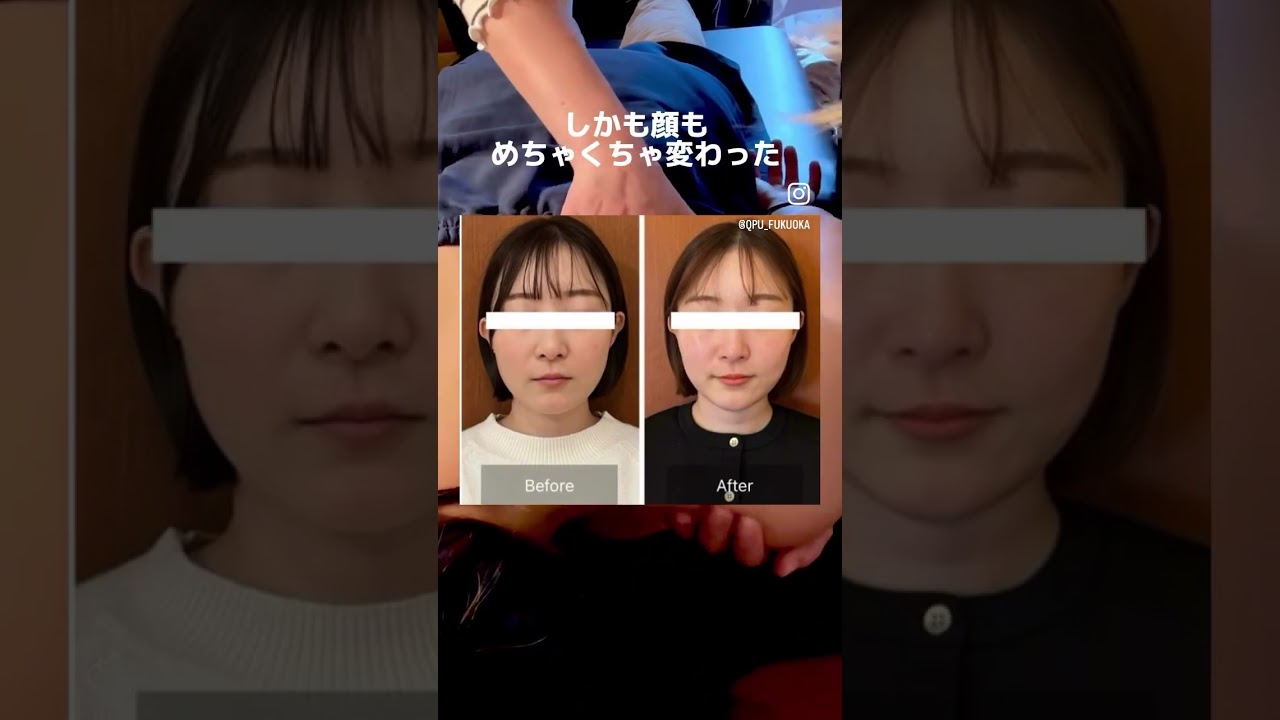 巻き肩矯正が受けられるのは全国44店舗中、福岡天神店、小倉店、下関店だけ🌟 #小顔マッサージ #ダイエット #姿勢改善 #猫背 #巻き肩