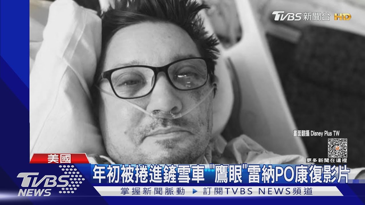 被輾斷30根骨頭!「鷹眼」PO康復影片 網看傻:恢復力也太強!