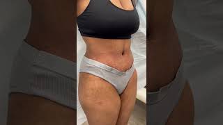 Download lagu What procedure did she have? mp3 Download lagu What procedure did she have? mp3