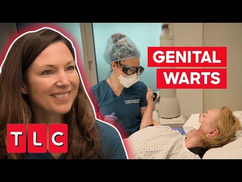 Dr. Emma Uses Lasers To Help A Woman With Genital Warts | The Bad Skin Clinic