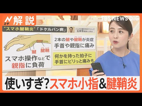 携帯電話の親指に注意:スマートフォンは関節を破壊します