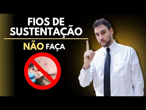 NÃO faça fios de sustentação!