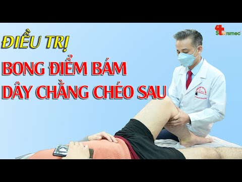 Bong điểm bám DÂY CHẰNG CHÉO SAU - Điều trị thế nào?