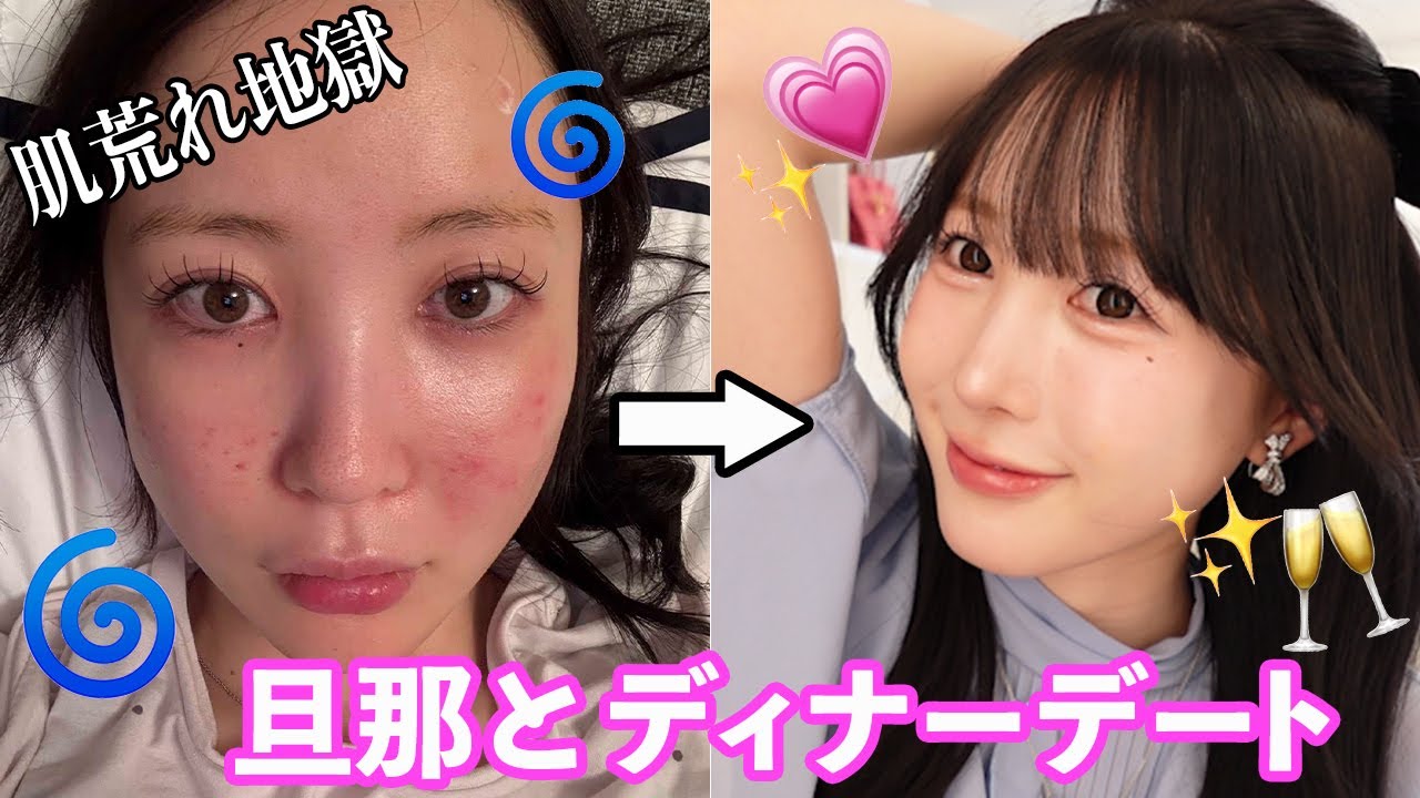 【肌荒れ】旦那と久々ディナーメイク‼妊活むずい...。