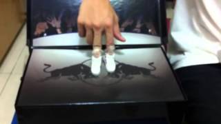 Kable's finger breaking