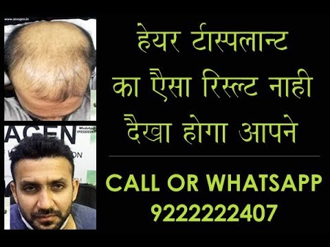 Anagen Hair Transplant Clinic- Mumbai, India • Read 18 Reviews Anagen Hair Transplant Clinic- Mumbai, India • Read 18 Reviews
