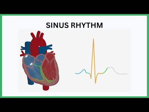 Sinus Rhythm Visualised