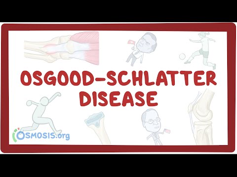 Osgood-Schlatter disease - causes, symptoms, diagnosis, treatment, pathology