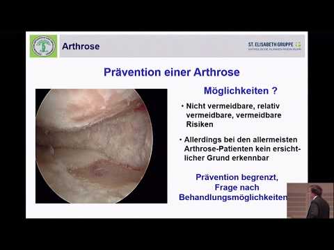 03/13 - Arthrose - Unvermeidbar? (2)