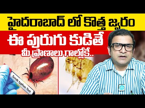 New fever in Hyderabad, danger if bitten by this insect | Scrub Typhus Disease Symptoms & Precaut...