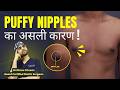 Puffy Nipples का असली कारण Treatment And Reasons Explained By Dr DC Plastic Surg
