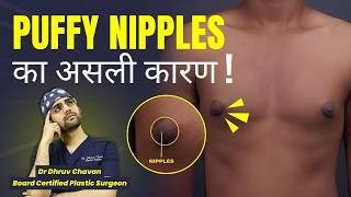 Puffy Nipples का असली कारण! | Treatment and Reasons | Explained By Dr DC, Plastic Surgeon Pune