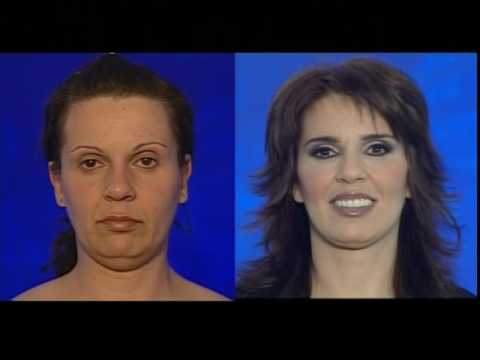 extreme_makeover