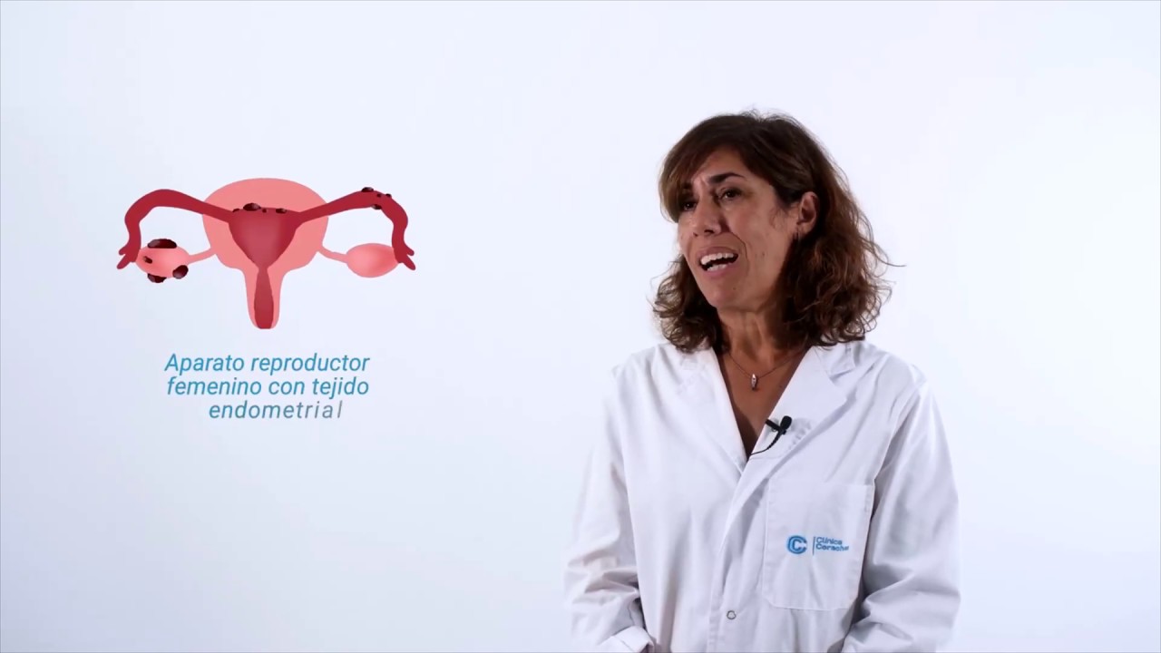 Mireia Fernandez Arias-12