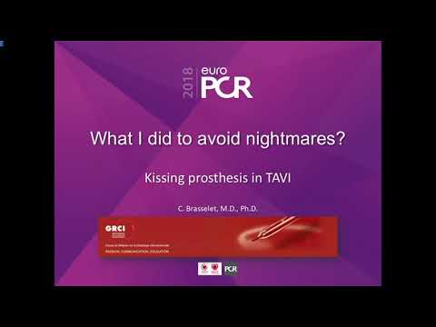 Left main stent inflat before tavi stent ,deflat lm stent after tavi to ptrevent lm close post tavi.