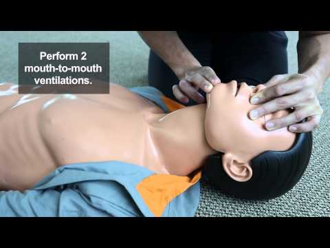 Mouth to Mouth Ventilations (CPR Steps)