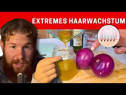 Onion Juice for Extreme Hair Growth: Stop Hair Loss