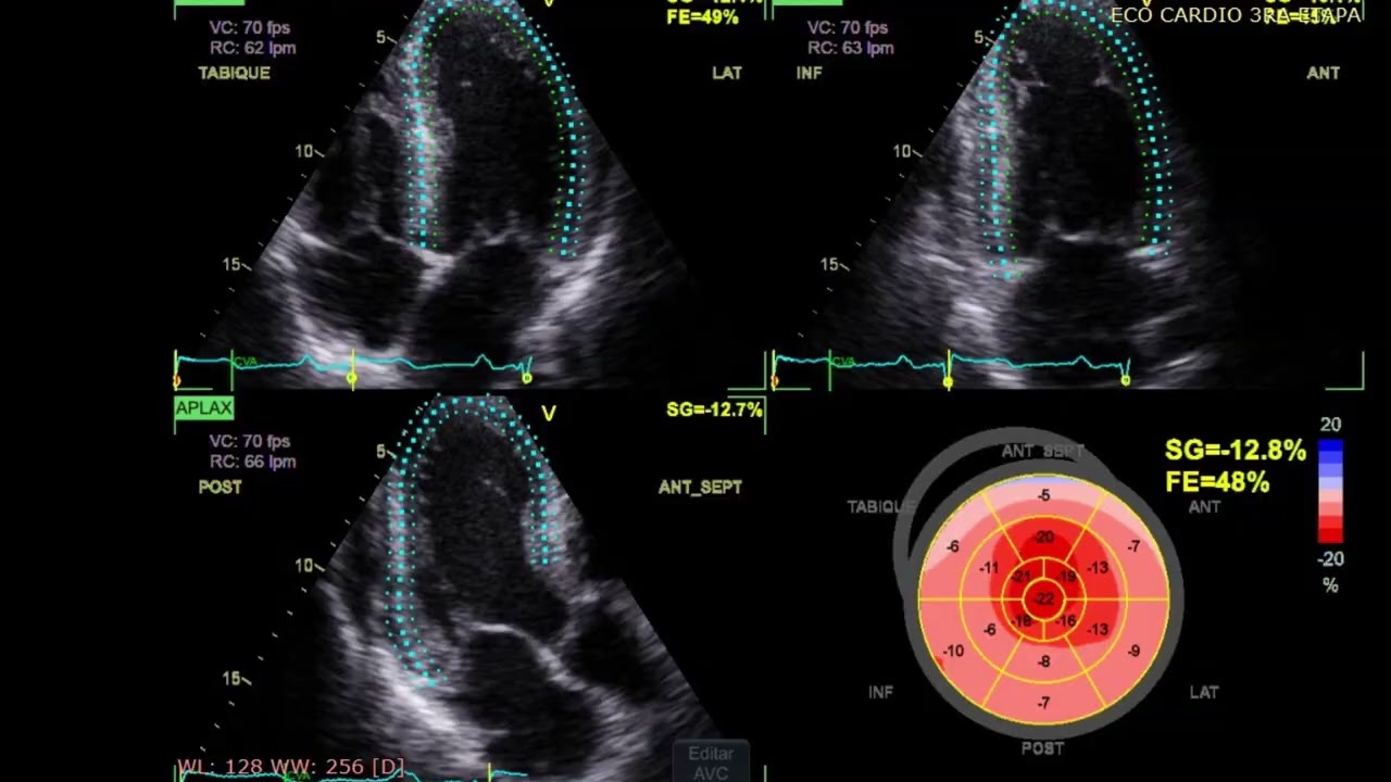 Luis  Ruvalcaba Figueroa -4