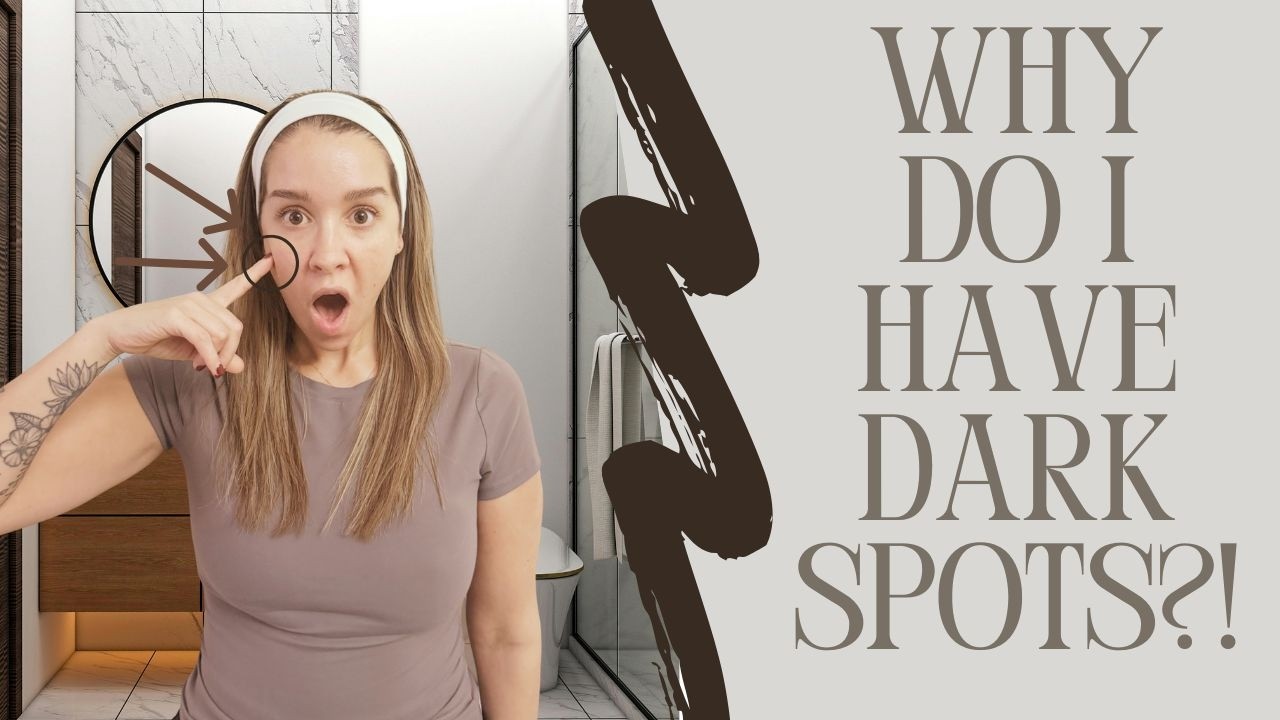 Hyperpigmentation Explained: Causes, Types, and How to Actually Treat It