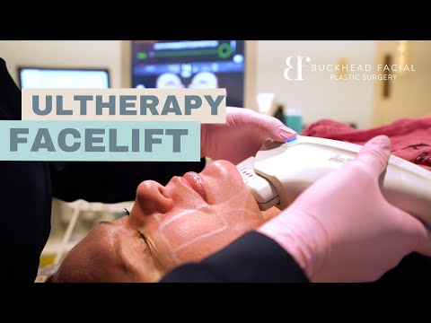 Ultherapy Neck Procedure and Facelift