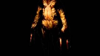 Silent Hill CST - 36 - Screamer's Revenge