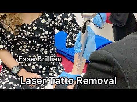 HAPUS TATTO ARTIS ESSA BRILLIAN 🔥