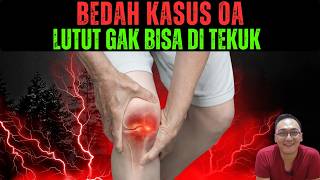 Download lagu After 15 years of being diagnosed with osteoarthritis, my knees can't bend. Inflammation of the j... mp3 Download lagu After 15 years of being diagnosed with osteoarthritis, my knees can't bend. Inflammation of the j... mp3