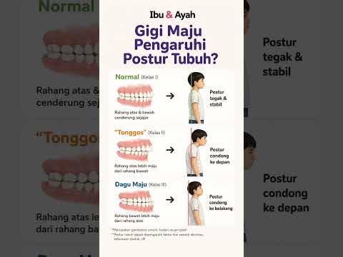 Gigi Maju Ternyata Bisa Pengaruhi Postur Tubuh Anak? Ini Penjelasannya #ibudanayah