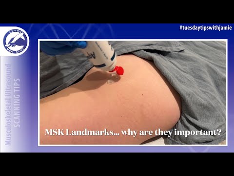 The importance of landmarks when performing MSK ultrasound exams