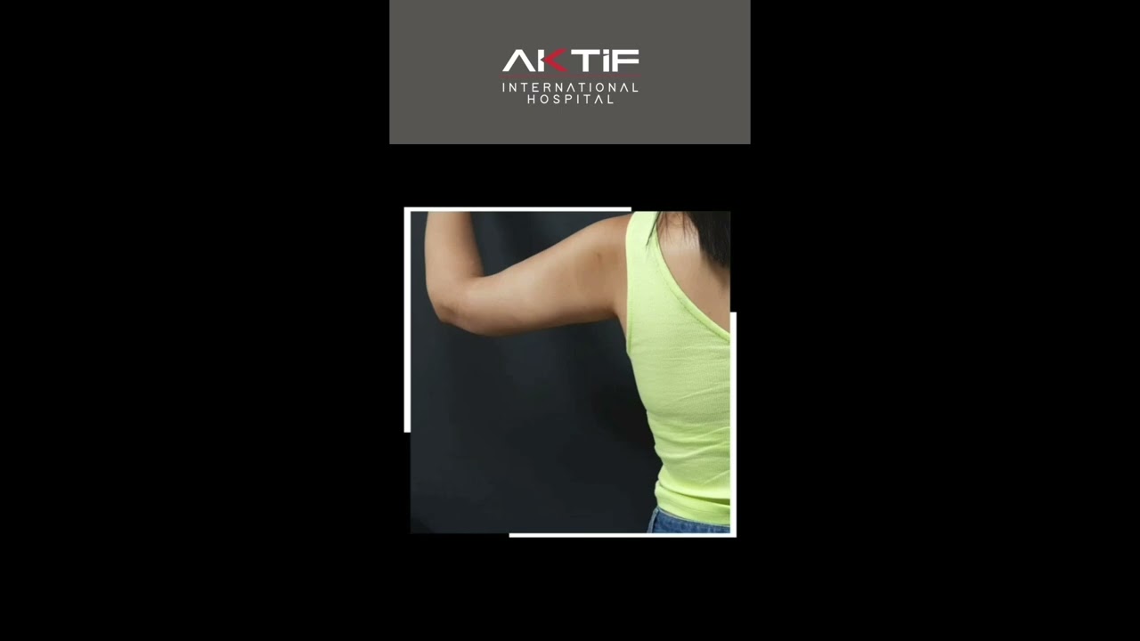 Arm Lift