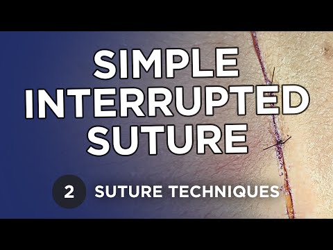 Simple Interrupted Suture - Learn Suture Techniques
