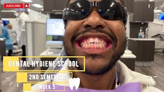 Dental Hygiene SchoolWeek 5Cavitron CleaningPassed