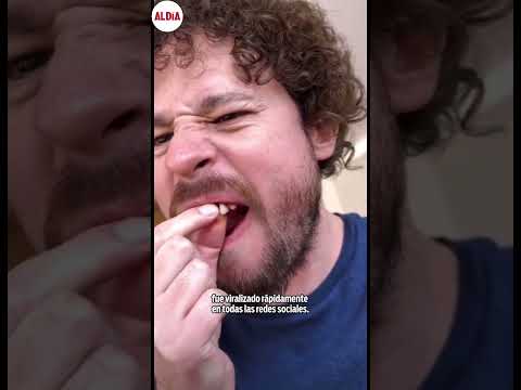 Se le CAEN dos dientes en plena transmisión en vivo a Luisito Comunica