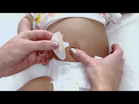 Baby Belly Button Shaper Instructions Video