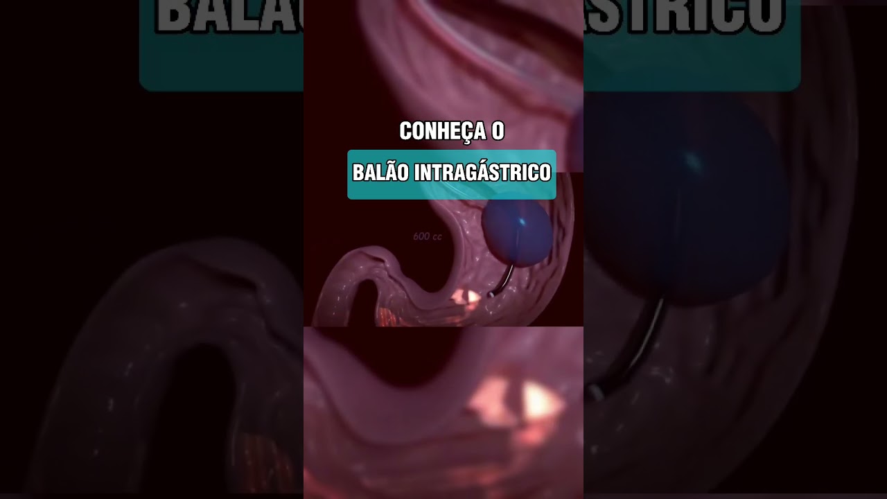 Jefferson Paes De Andrade-45