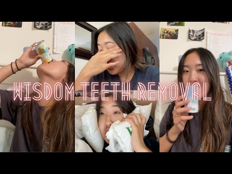 YouTube video about: Does drinking pineapple juice help with wisdom teeth?