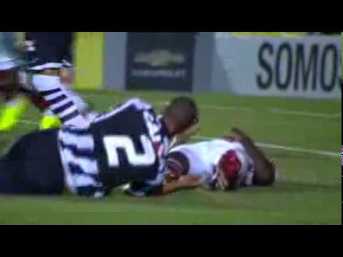 Figueirense 1 x 1 Fluminense Melhores Momentos Do Brasileirão Serié A 10/09/2014