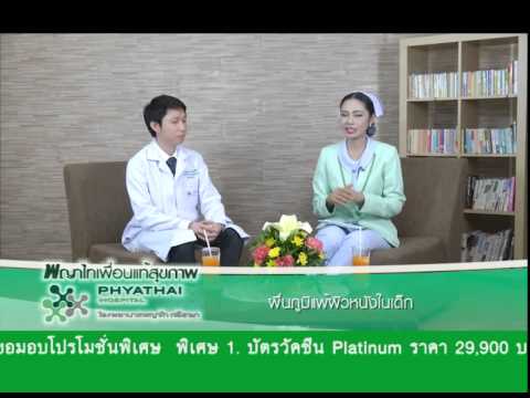 D. การรักษา Pagano ของโรคสะเก็ดเงิน Neurodermatitis รูปภาพในร่างกายมนุษย์